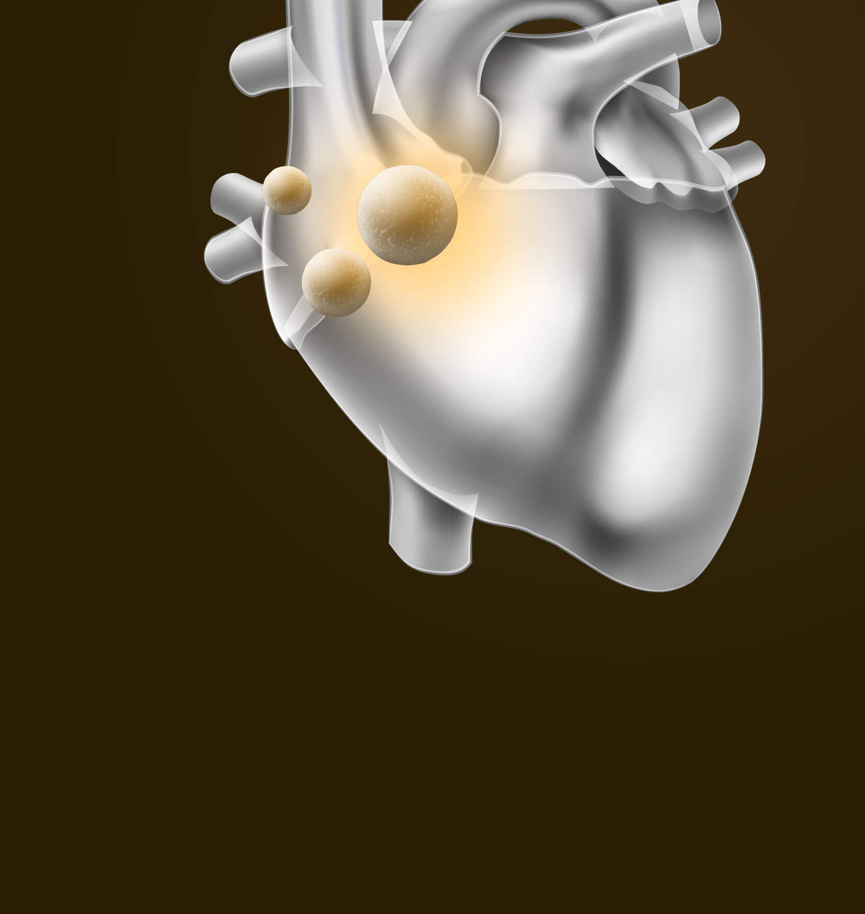 心脏病专家 - 心脏病护理