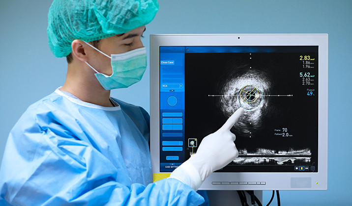 Cardiac Imaging