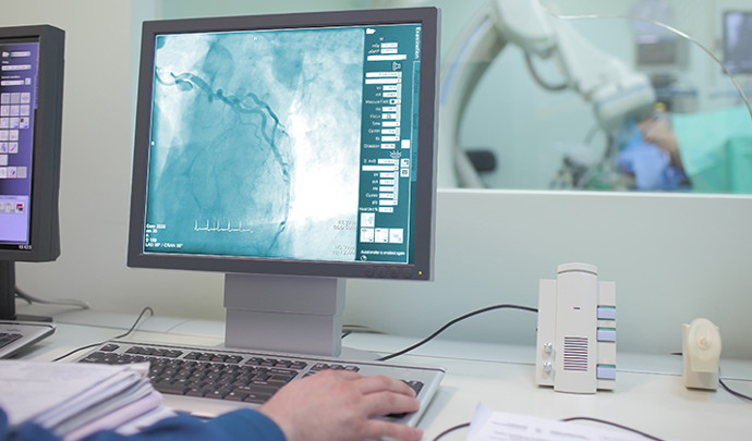 Coronary Angiography Coronary Angiography