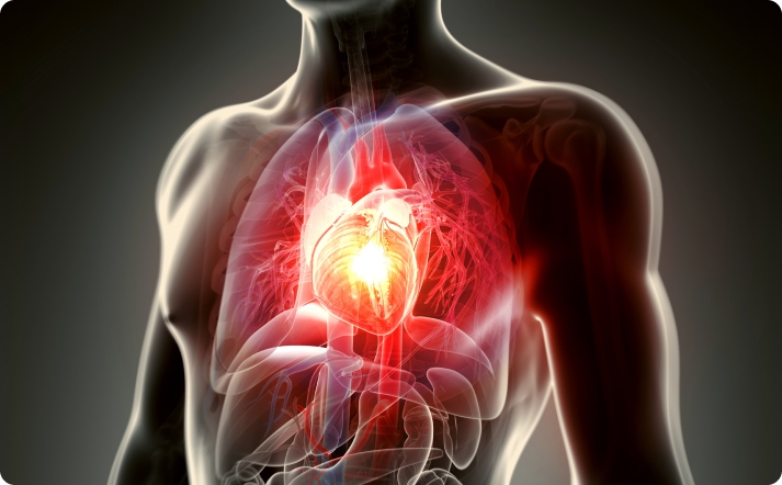 Angioplasty procedure in Singapore