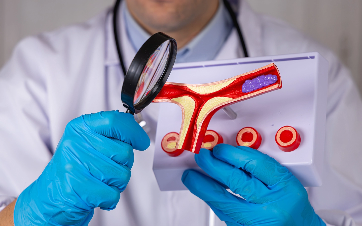 A doctor examining a diagram of a blocked artery
