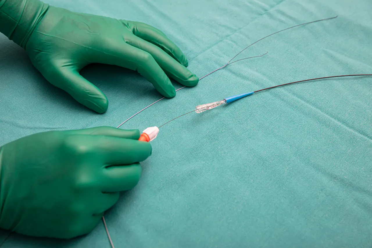 What You Need to Know About Angioplasty