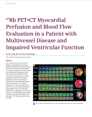 Media 2014 82rb Pet•Ct Myocardial Perfusion