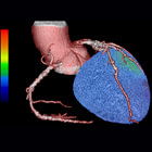 Our Services 最新のハイブリッド PET CT